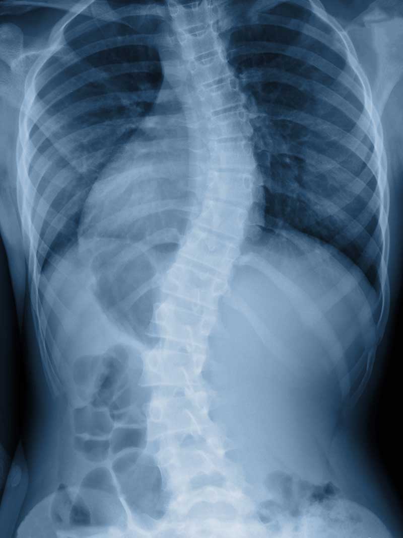 chiropractic conditions treated  Bronx, NY